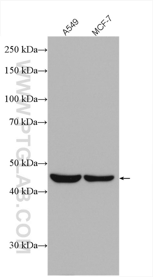 L2HGDH Antibody in Western Blot (WB)