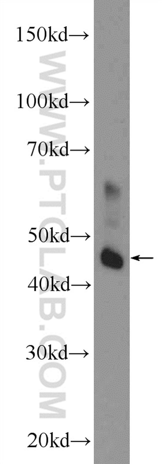 L2HGDH Antibody in Western Blot (WB)