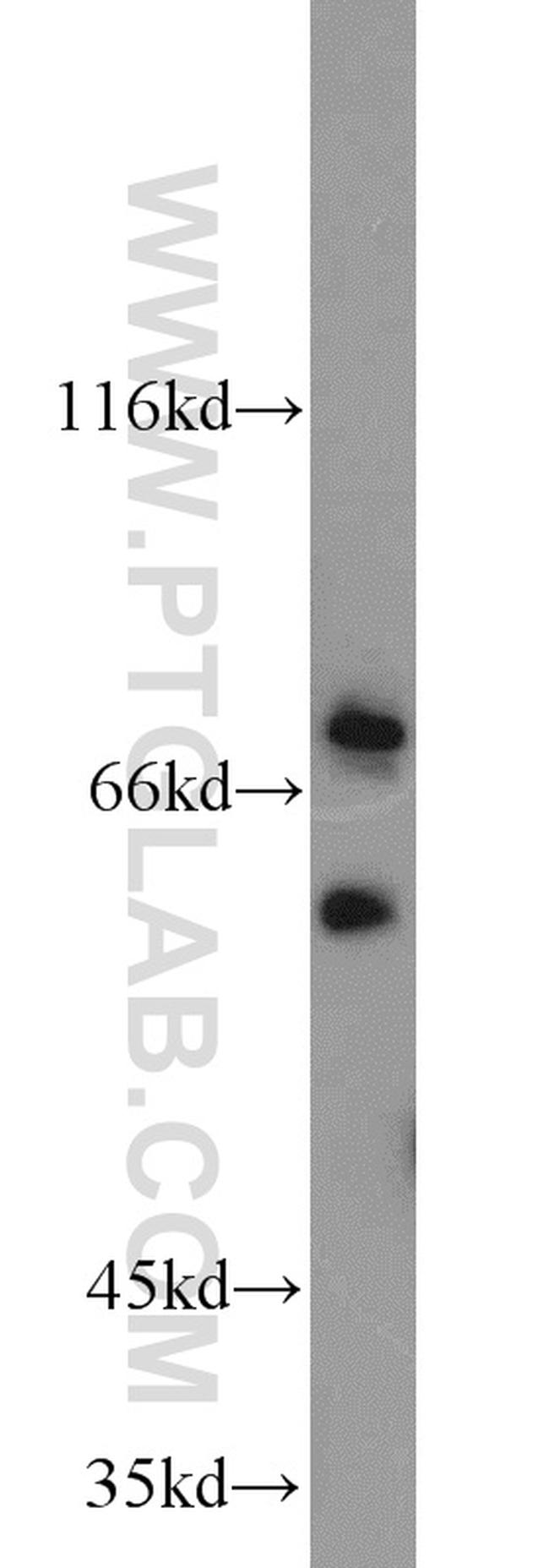 ACSL5 Antibody in Western Blot (WB)