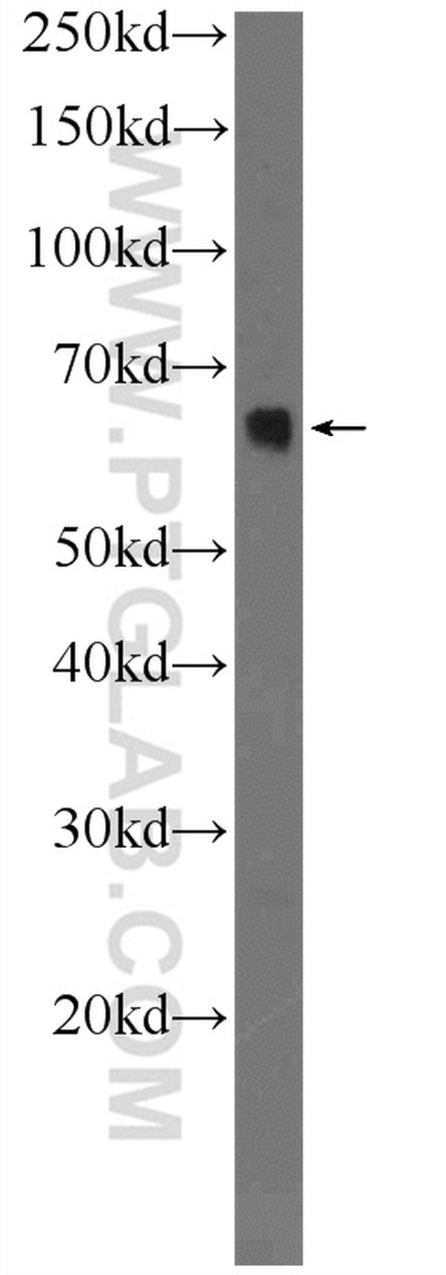 ACSL5 Antibody in Western Blot (WB)