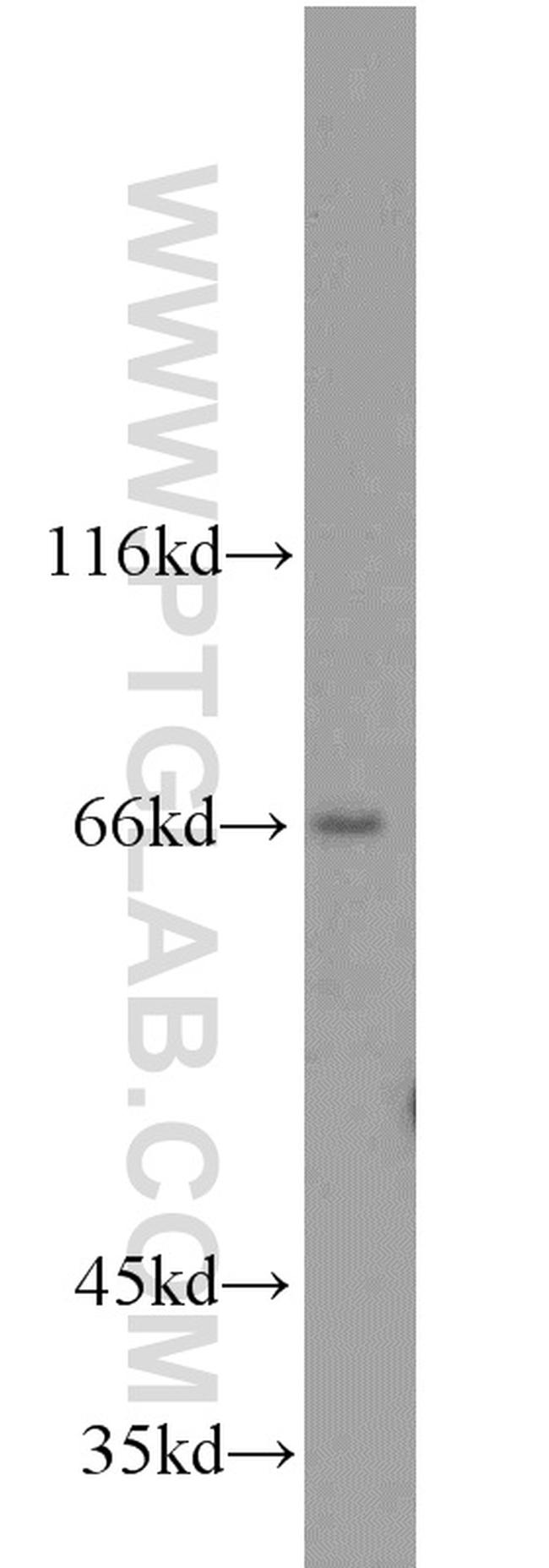 ACSL5 Antibody in Western Blot (WB)