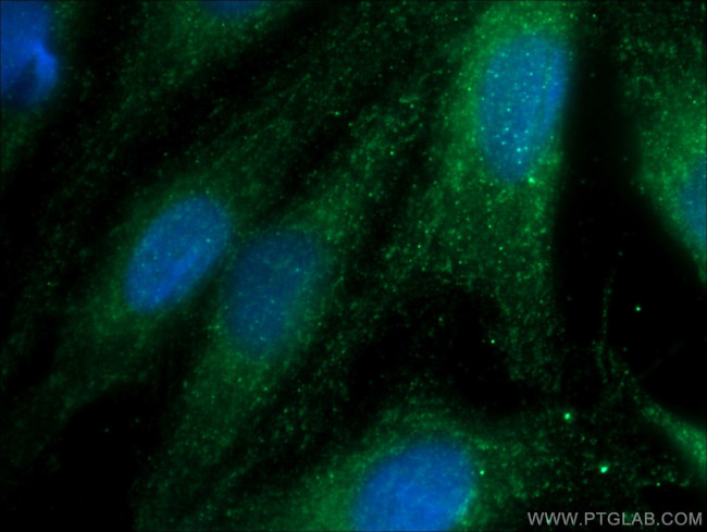 GSS Antibody in Immunocytochemistry (ICC/IF)