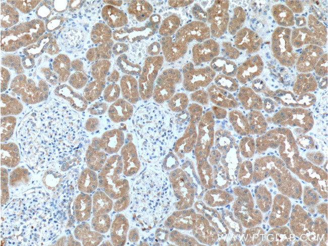 GSS Antibody in Immunohistochemistry (Paraffin) (IHC (P))