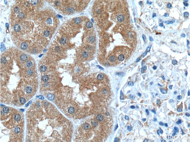 GSS Antibody in Immunohistochemistry (Paraffin) (IHC (P))