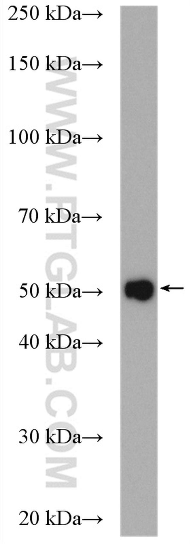 GSS Antibody in Western Blot (WB)