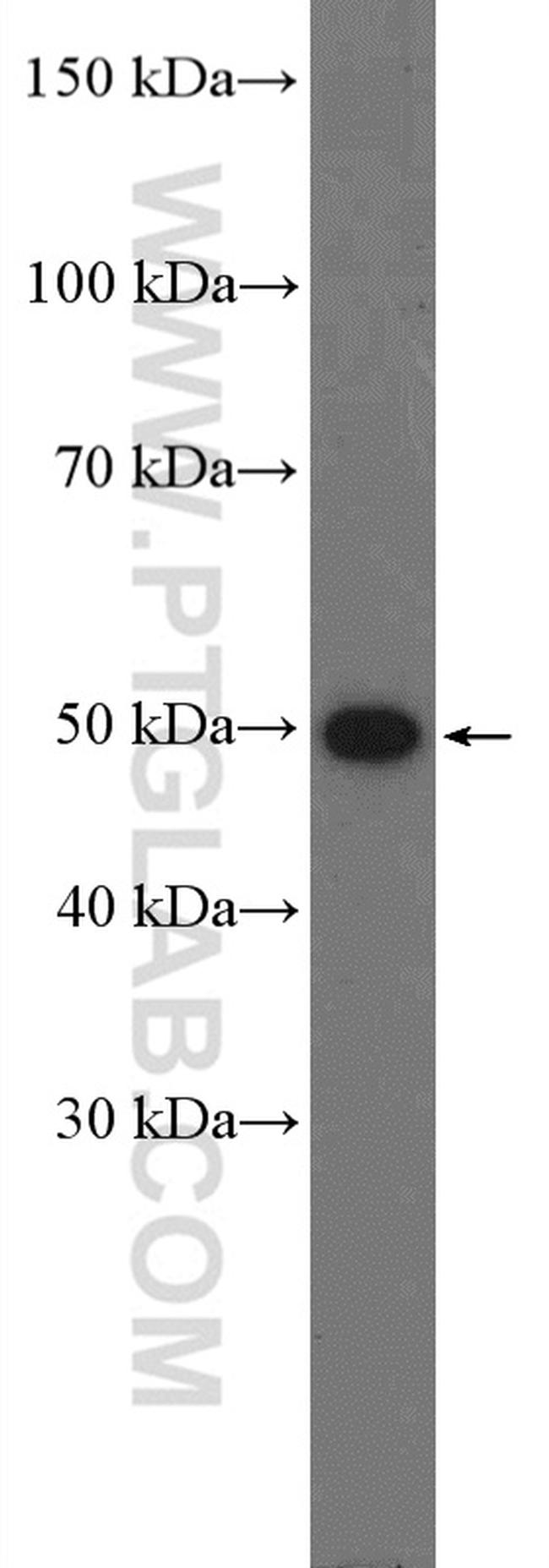 GSS Antibody in Western Blot (WB)