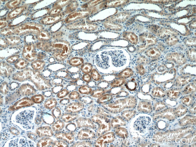 NARS2 Antibody in Immunohistochemistry (Paraffin) (IHC (P))