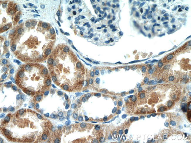 NARS2 Antibody in Immunohistochemistry (Paraffin) (IHC (P))