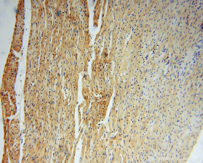 NARS2 Antibody in Immunohistochemistry (Paraffin) (IHC (P))