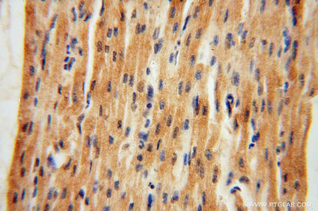 NARS2 Antibody in Immunohistochemistry (Paraffin) (IHC (P))