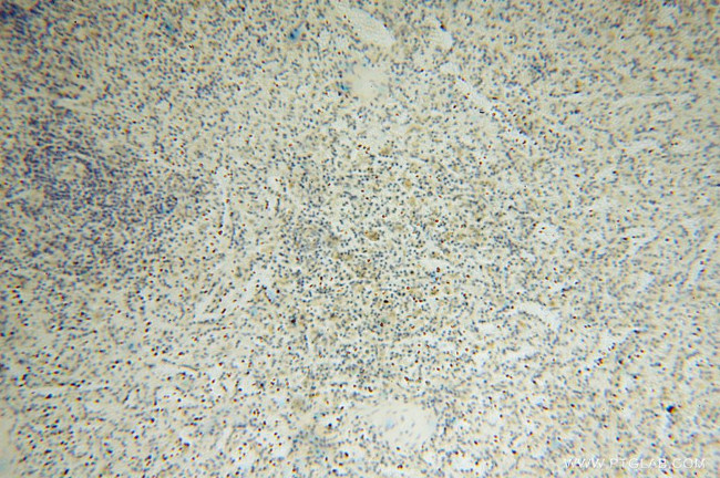 NARS2 Antibody in Immunohistochemistry (Paraffin) (IHC (P))