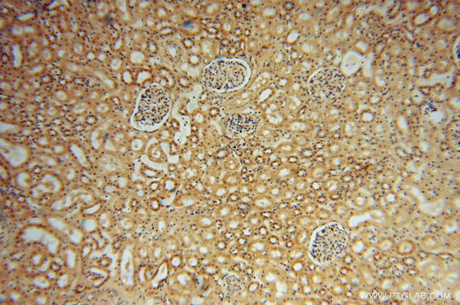 NARS2 Antibody in Immunohistochemistry (Paraffin) (IHC (P))