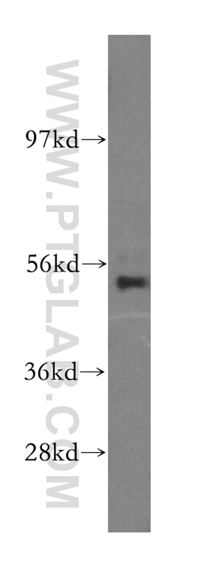NARS2 Antibody in Western Blot (WB)