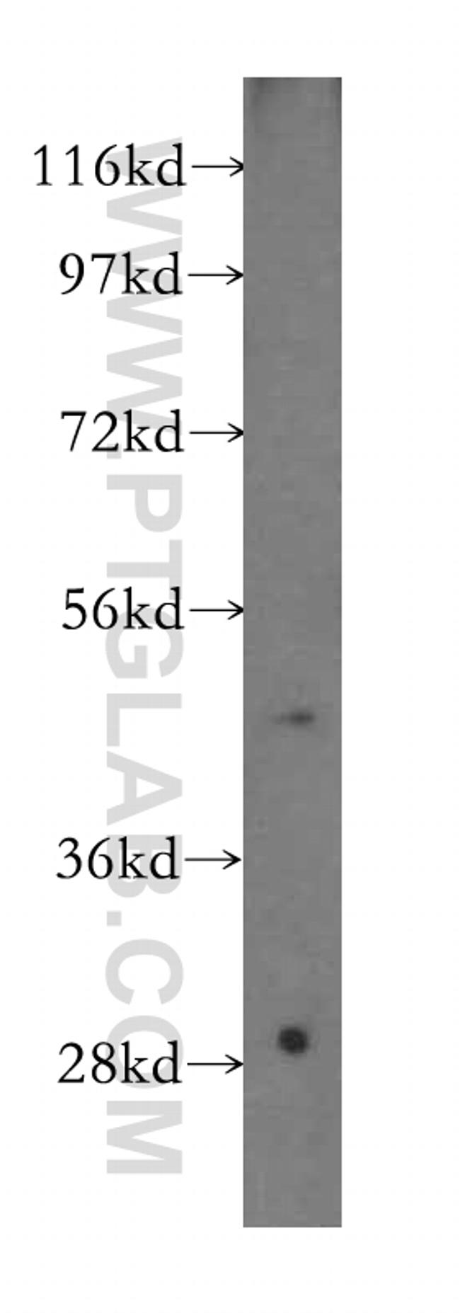 NARS2 Antibody in Western Blot (WB)