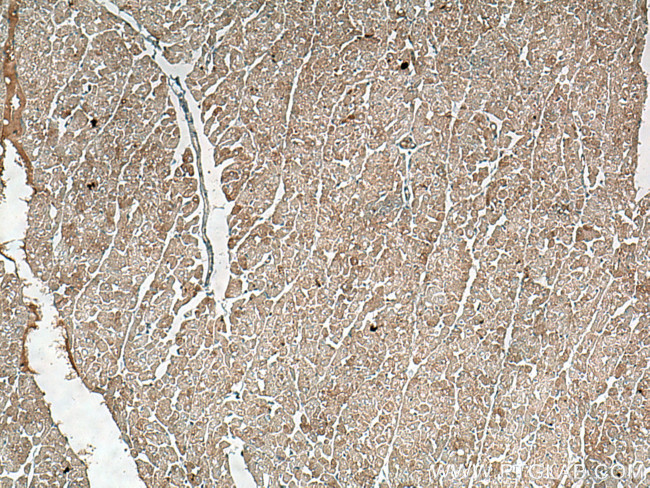 BCKDK Antibody in Immunohistochemistry (Paraffin) (IHC (P))