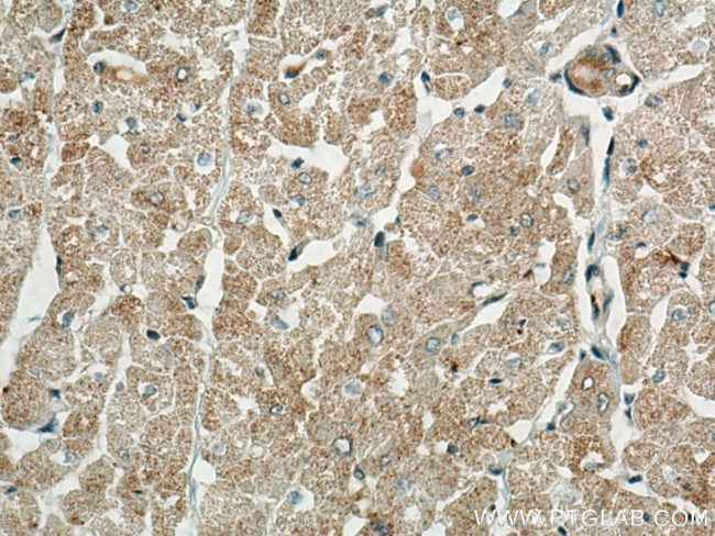 BCKDK Antibody in Immunohistochemistry (Paraffin) (IHC (P))