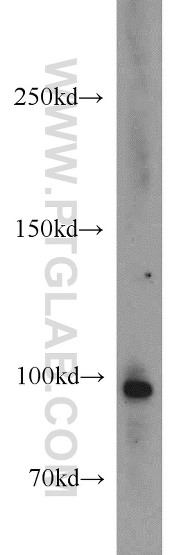 TUBGCP3 Antibody in Western Blot (WB)
