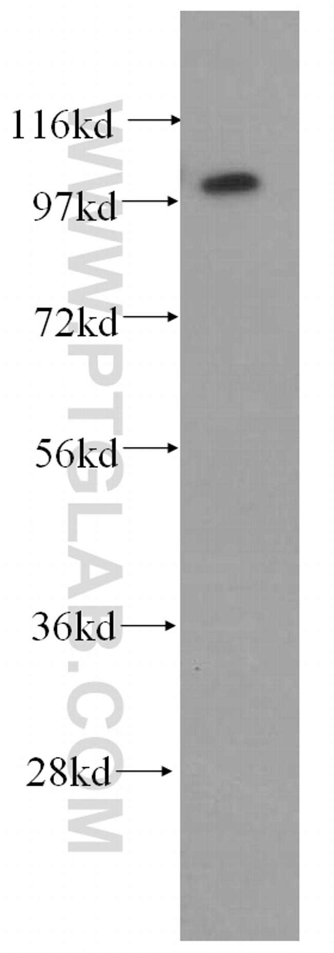 TUBGCP3 Antibody in Western Blot (WB)