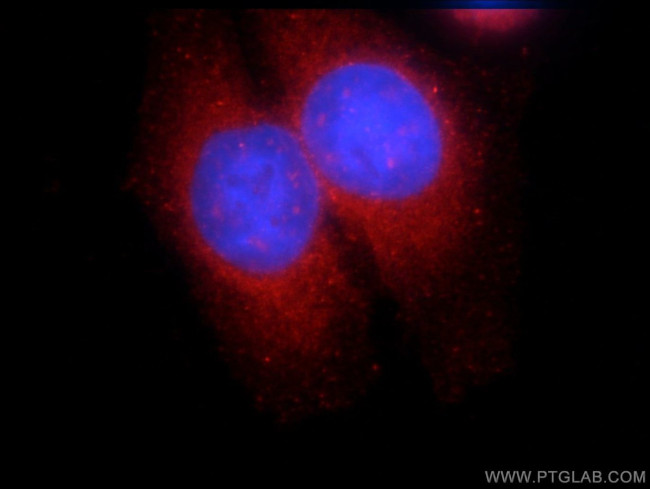 SNX9 Antibody in Immunocytochemistry (ICC/IF)