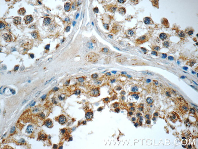 AP2A2 Antibody in Immunohistochemistry (Paraffin) (IHC (P))