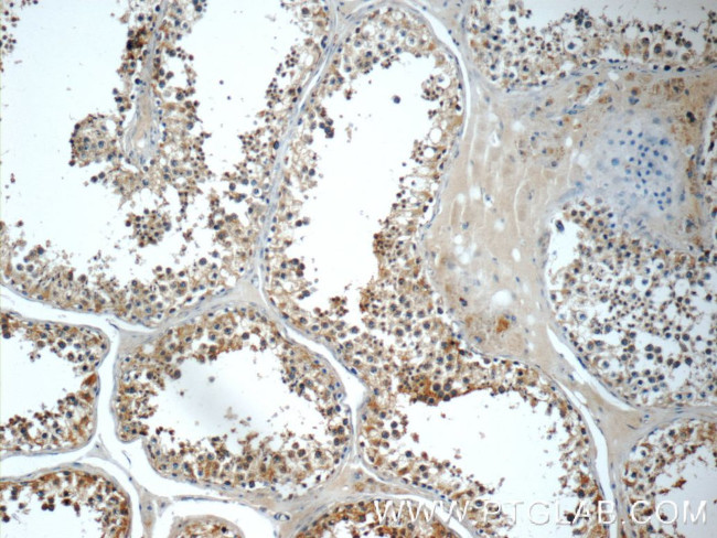 AP2A2 Antibody in Immunohistochemistry (Paraffin) (IHC (P))