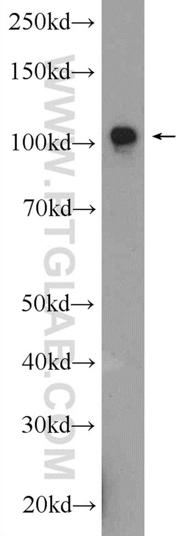 AP2A2 Antibody in Western Blot (WB)