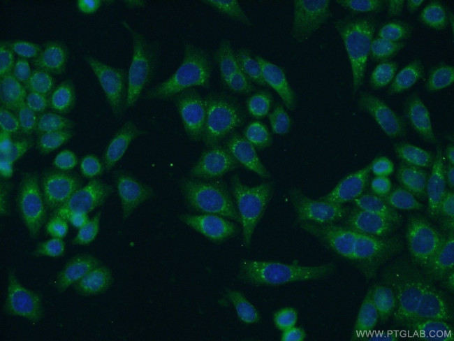 CRTAP Antibody in Immunocytochemistry (ICC/IF)