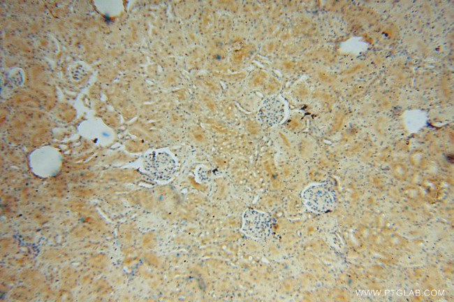 CRTAP Antibody in Immunohistochemistry (Paraffin) (IHC (P))