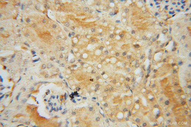 CRTAP Antibody in Immunohistochemistry (Paraffin) (IHC (P))