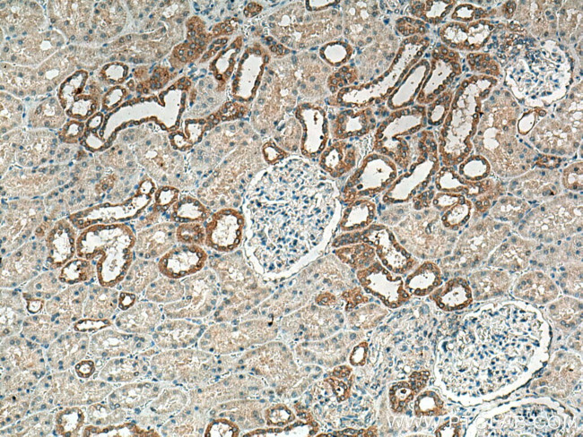 CRTAP Antibody in Immunohistochemistry (Paraffin) (IHC (P))