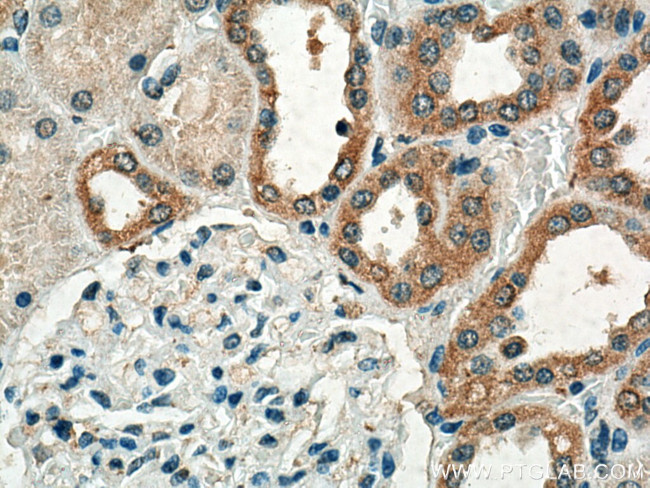 CRTAP Antibody in Immunohistochemistry (Paraffin) (IHC (P))