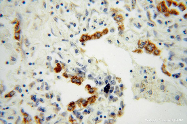 FMO2 Antibody in Immunohistochemistry (Paraffin) (IHC (P))