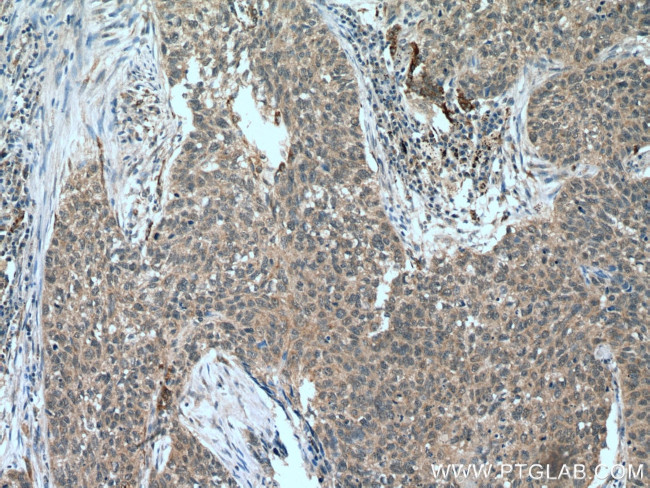 FMO2 Antibody in Immunohistochemistry (Paraffin) (IHC (P))