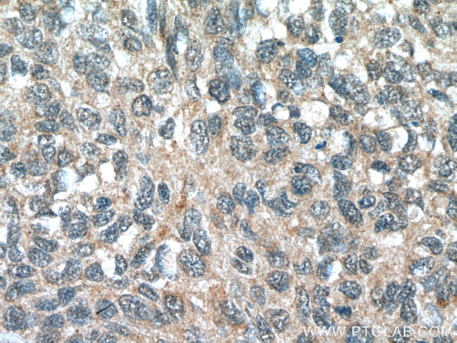 FMO2 Antibody in Immunohistochemistry (Paraffin) (IHC (P))