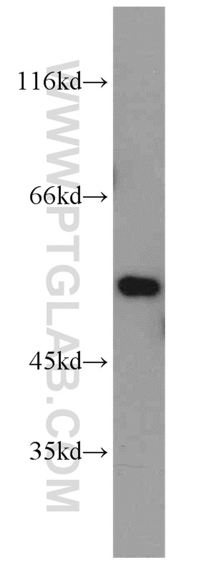 FMO2 Antibody in Western Blot (WB)