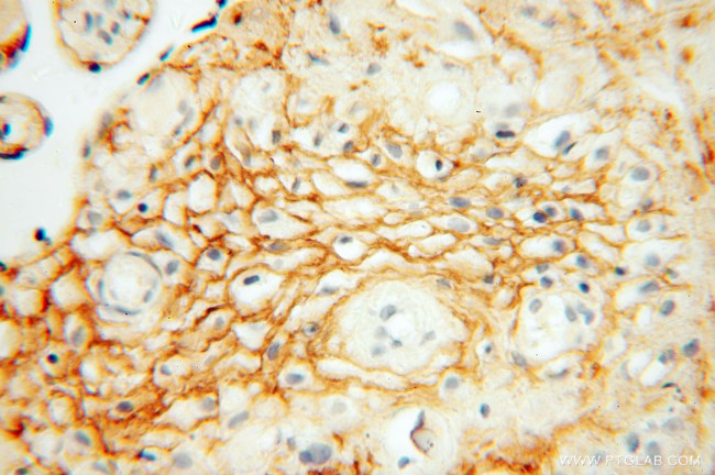 MFAP5 Antibody in Immunohistochemistry (Paraffin) (IHC (P))