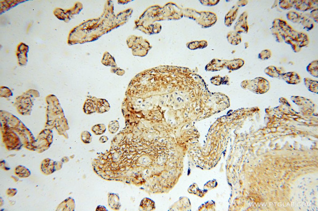 MFAP5 Antibody in Immunohistochemistry (Paraffin) (IHC (P))