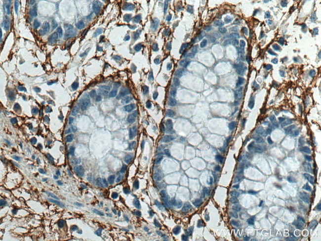 MFAP5 Antibody in Immunohistochemistry (Paraffin) (IHC (P))