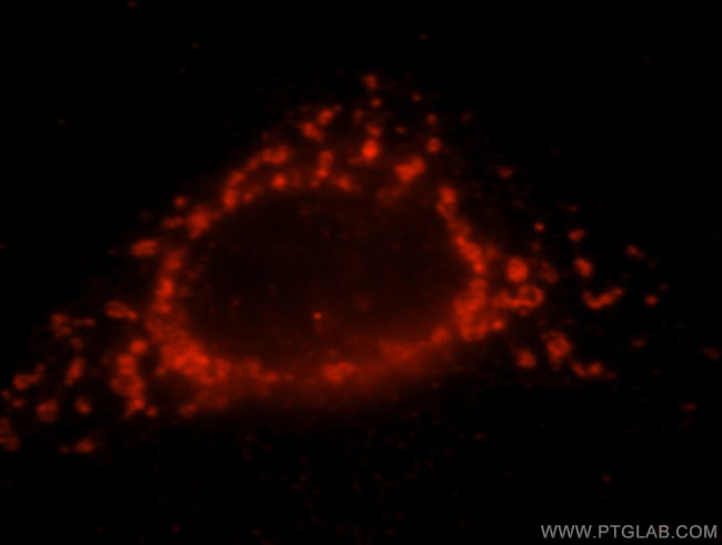 NDUFS7 Antibody in Immunocytochemistry (ICC/IF)