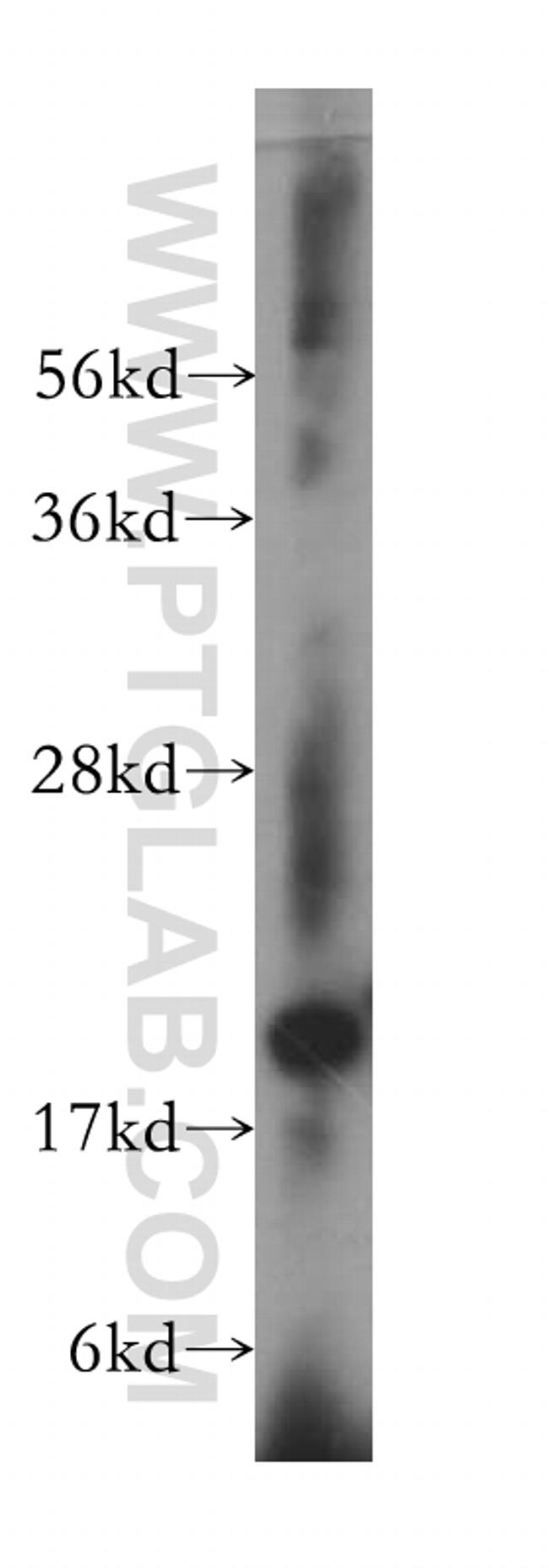 NDUFS7 Antibody in Western Blot (WB)