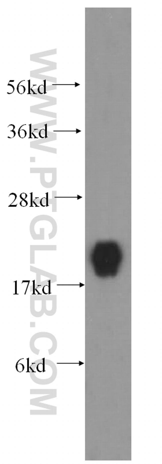 IFT25 Antibody in Western Blot (WB)