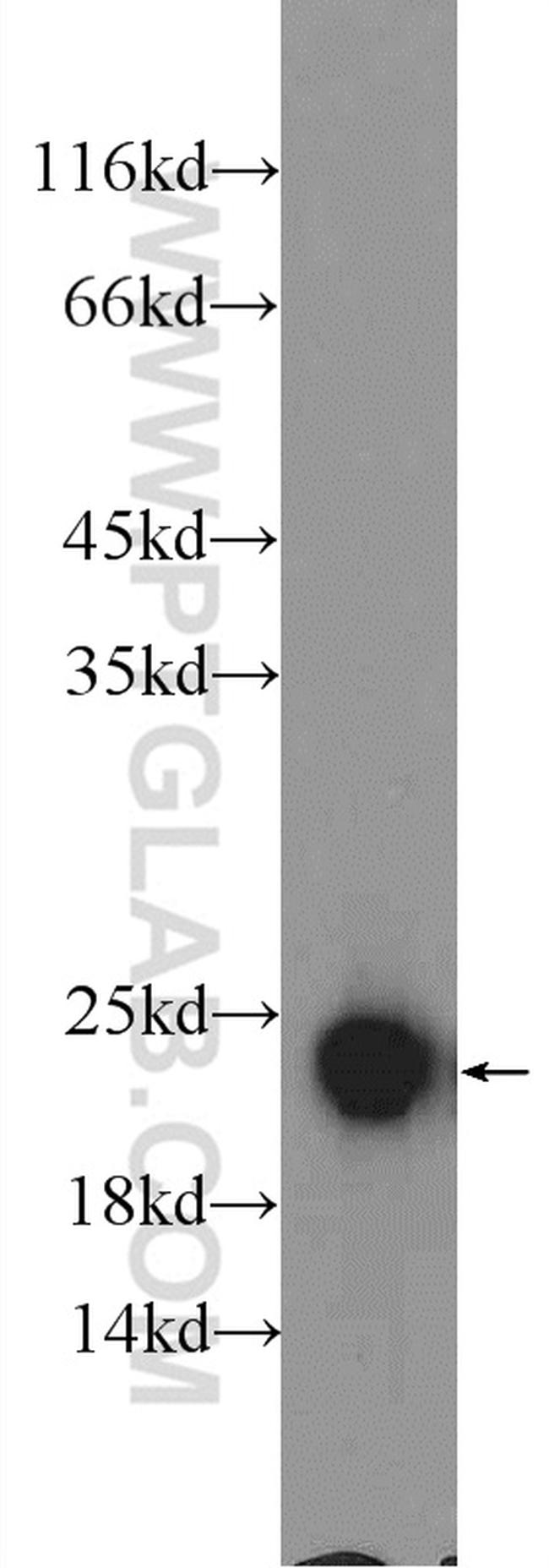 IFT25 Antibody in Western Blot (WB)