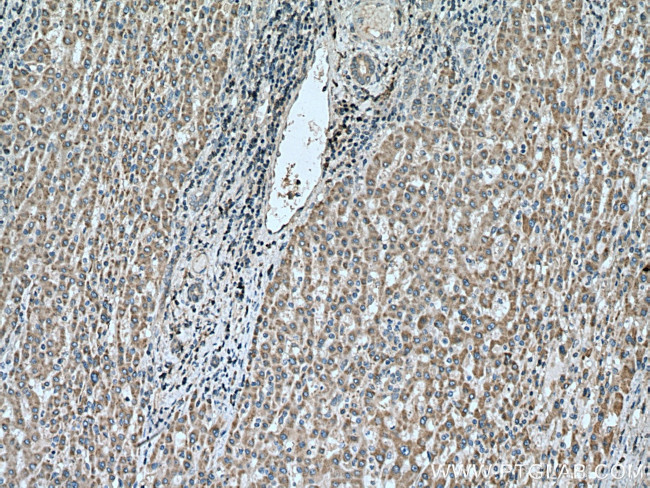 DHRS2 Antibody in Immunohistochemistry (Paraffin) (IHC (P))