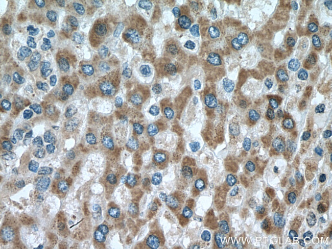 DHRS2 Antibody in Immunohistochemistry (Paraffin) (IHC (P))