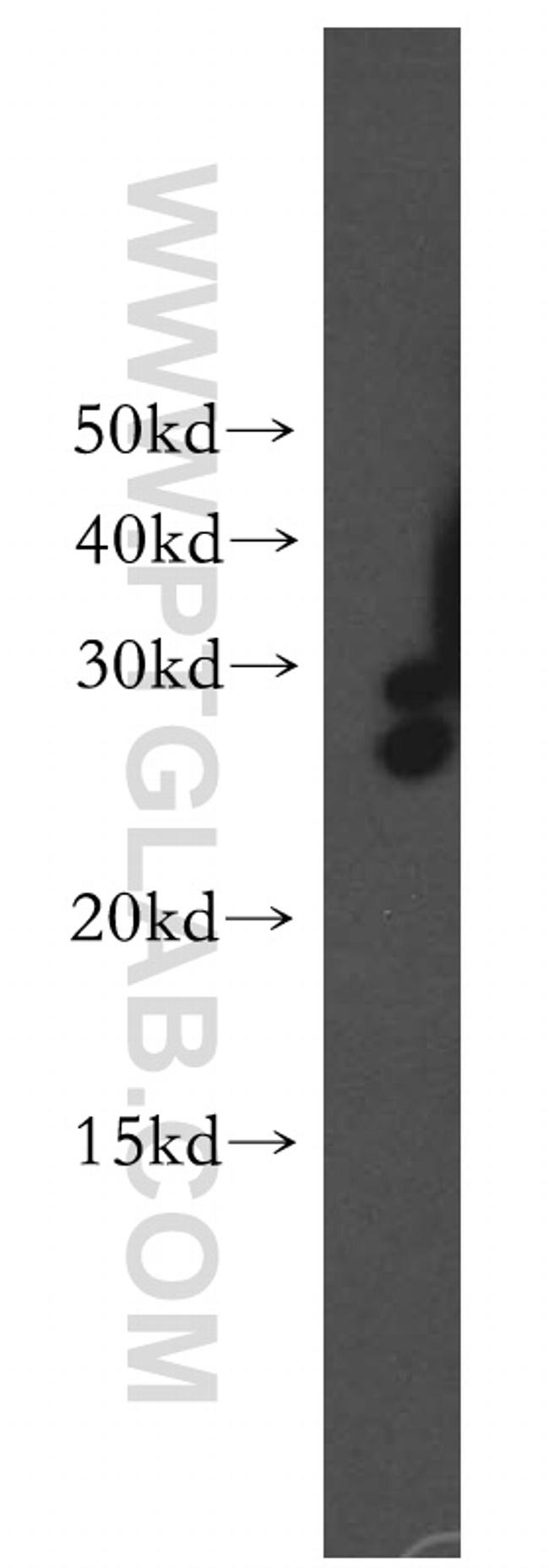 DHRS2 Antibody in Western Blot (WB)