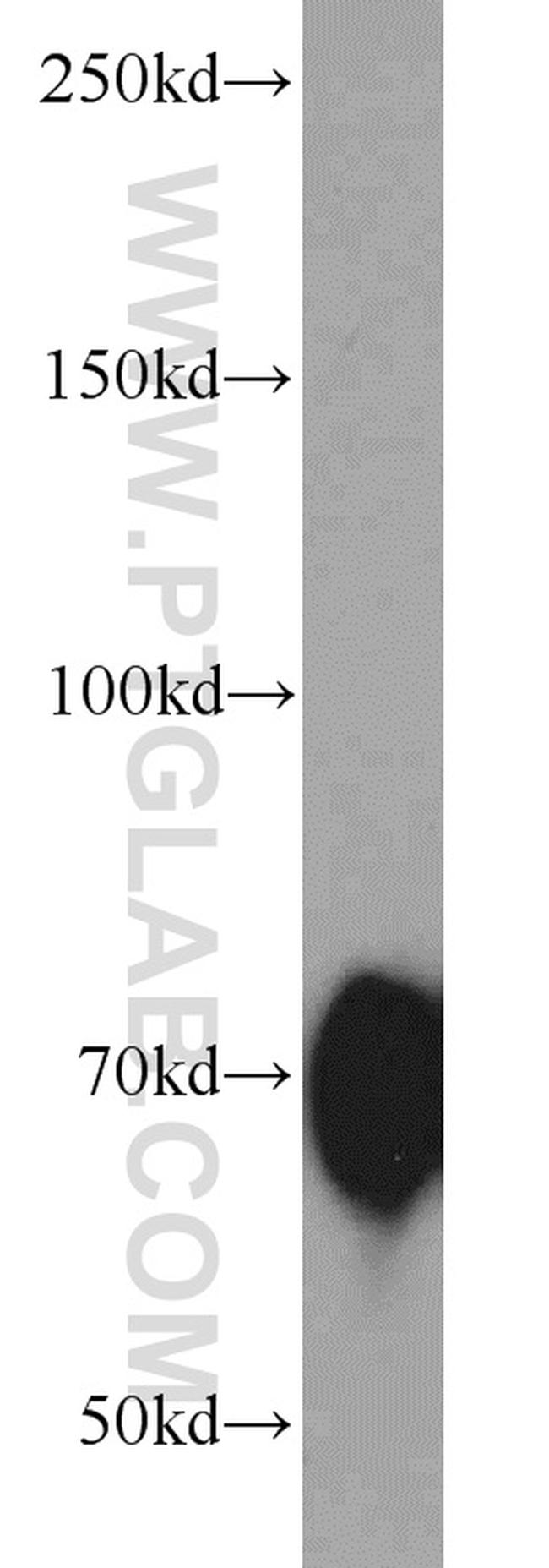 Hemopexin Antibody in Western Blot (WB)