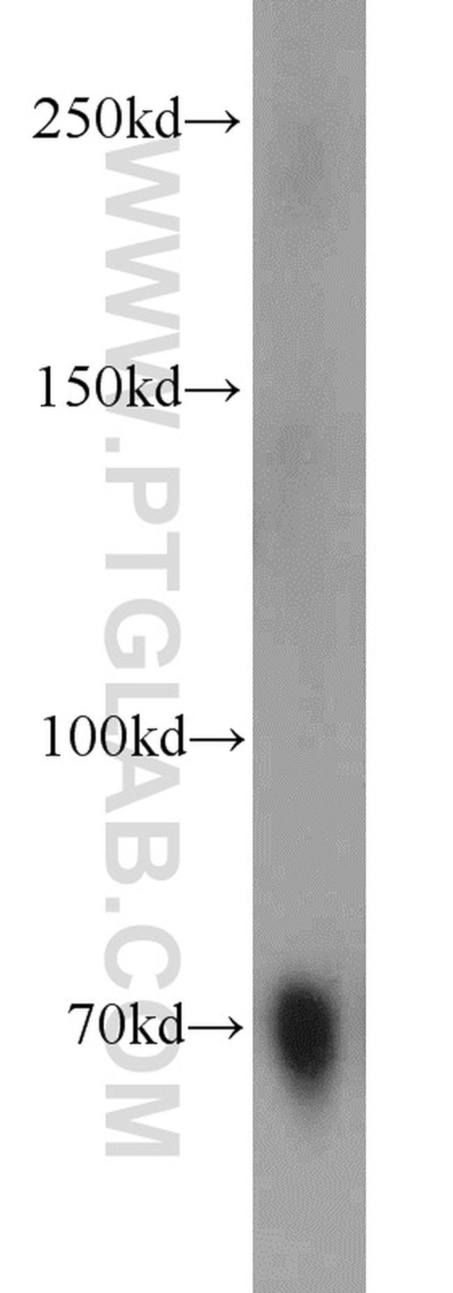 Hemopexin Antibody in Western Blot (WB)