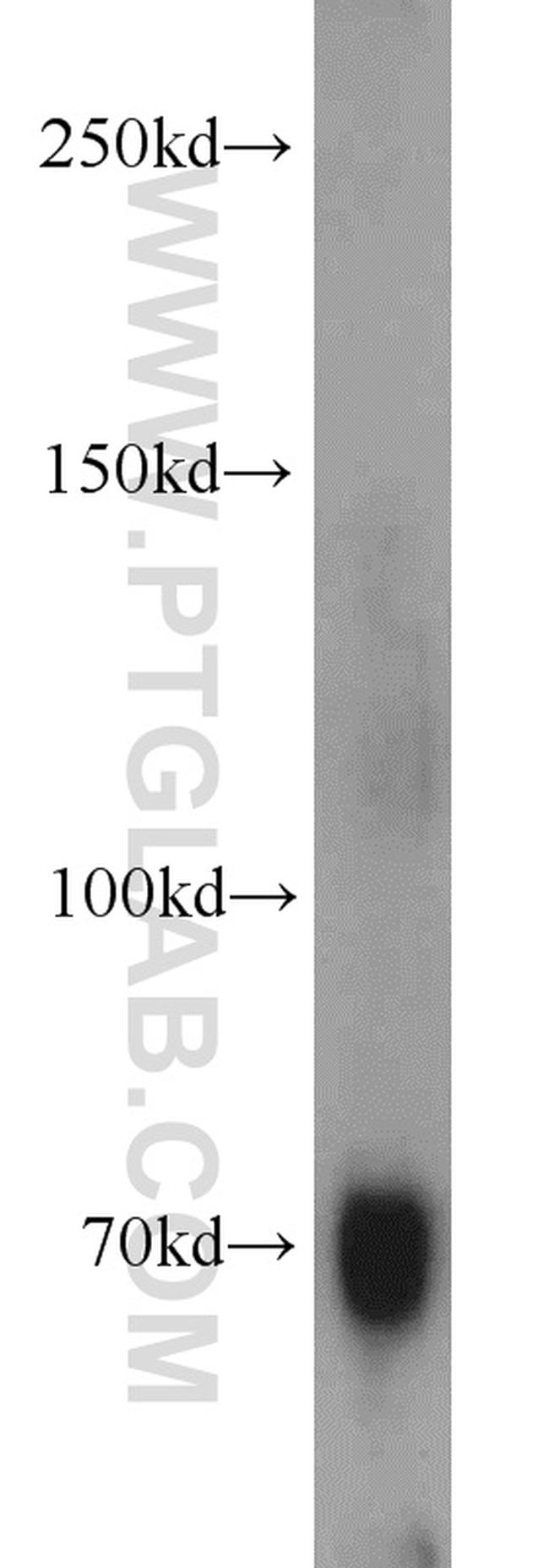 Hemopexin Antibody in Western Blot (WB)