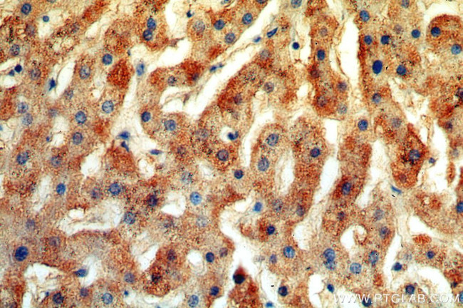 TRIM14 Antibody in Immunohistochemistry (Paraffin) (IHC (P))