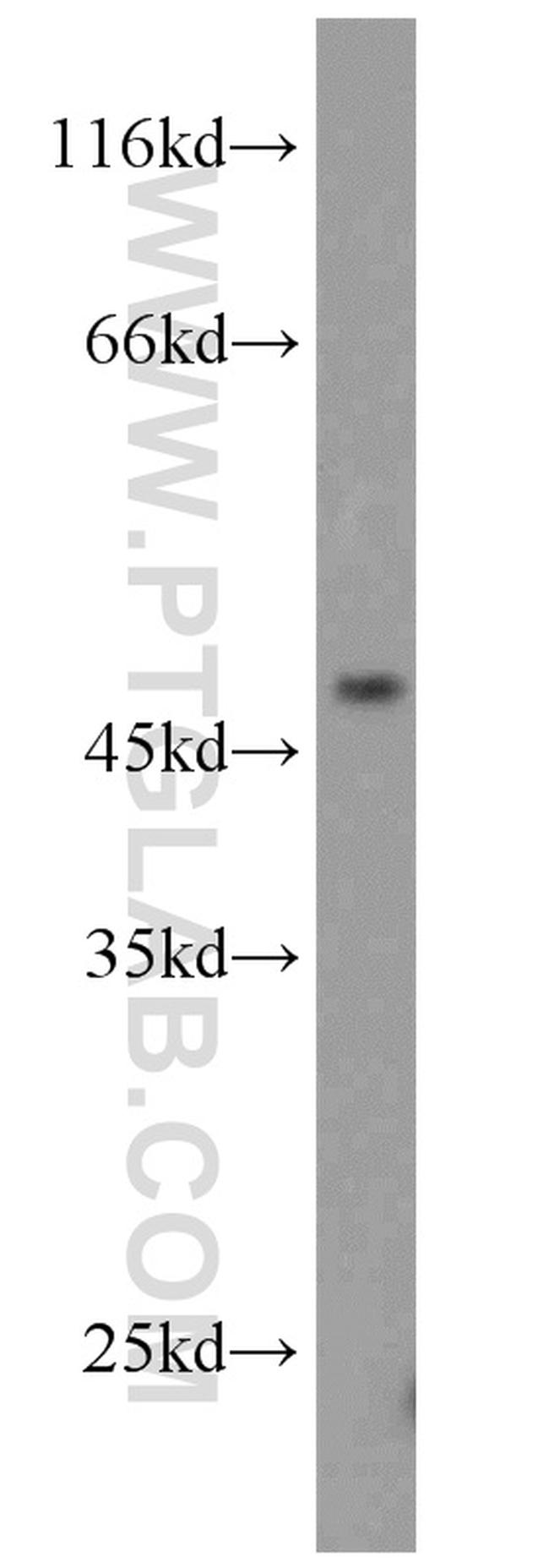 TRIM14 Antibody in Western Blot (WB)